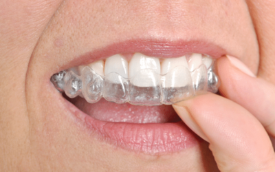 Invisalign in Bergen County NJ