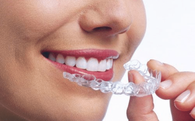 Average Cost Of Invisalign