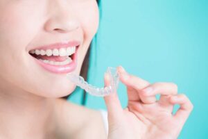 Average Cost of Invisalign