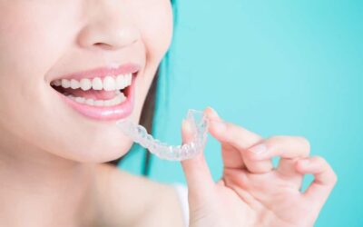 Average Cost of Invisalign