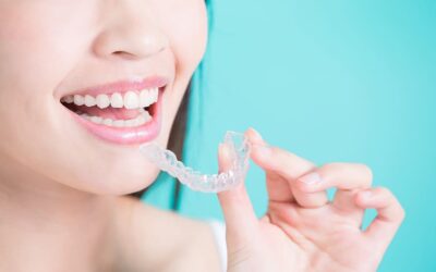 How Much Does Invisalign Cost