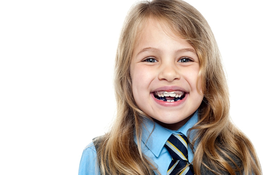 Earliest age for braces