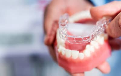 Invisalign for Teens: Why It’s a Popular Choice for Young Smiles