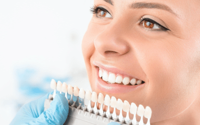 10 Secrets to a Radiant Smile: The Ultimate Guide to Teeth Whitening